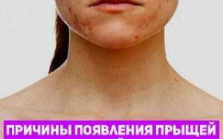 Как избавиться от прыщей на груди