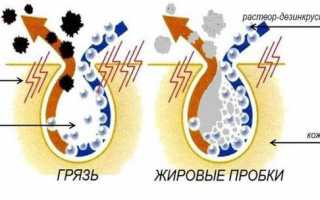 Чем отличается ионофорез от дезинкрустации