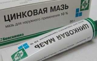 Цинковая мазь от пигментации