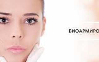 Биоармирование лица гиалуроновой кислотой