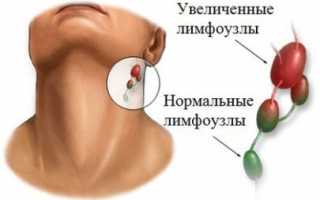 На шее под подбородком уплотнение